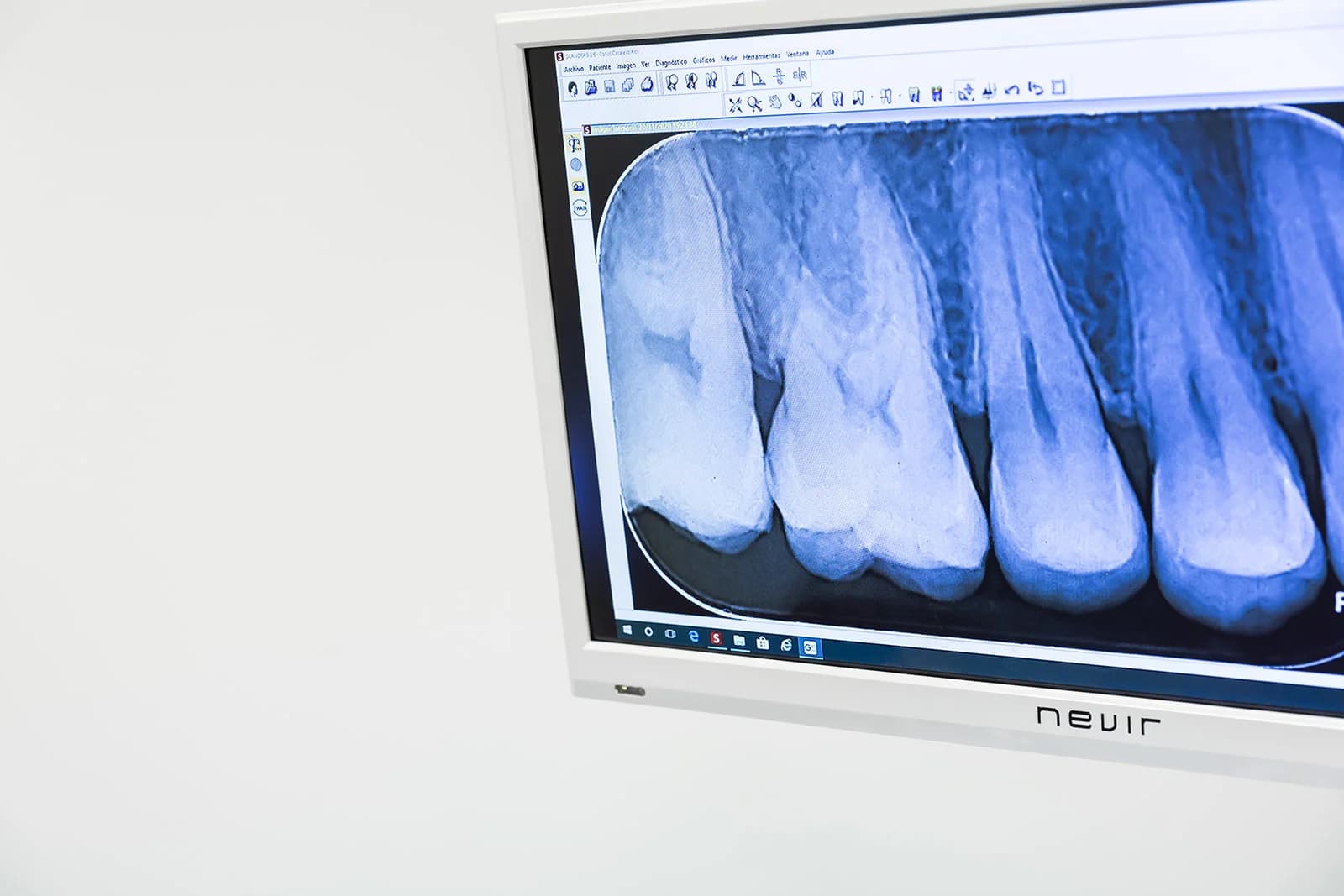 ENDODONCIA